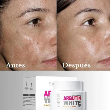 ARBUTIN WHITE ORIGINAL ✨ Sin Químicos Agresivos ✨