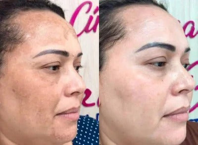 ARBUTIN WHITE ORIGINAL ✨ Sin Químicos Agresivos ✨