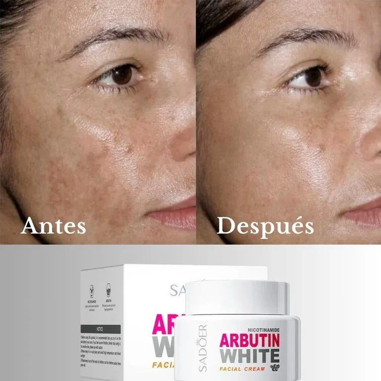 ARBUTIN WHITE ORIGINAL ✨ Sin Químicos Agresivos ✨