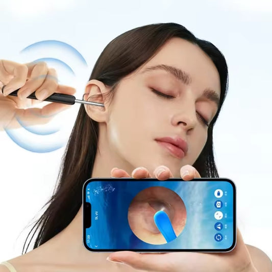 🔍 Limpieza de oídos profesional desde casa con cámara HD